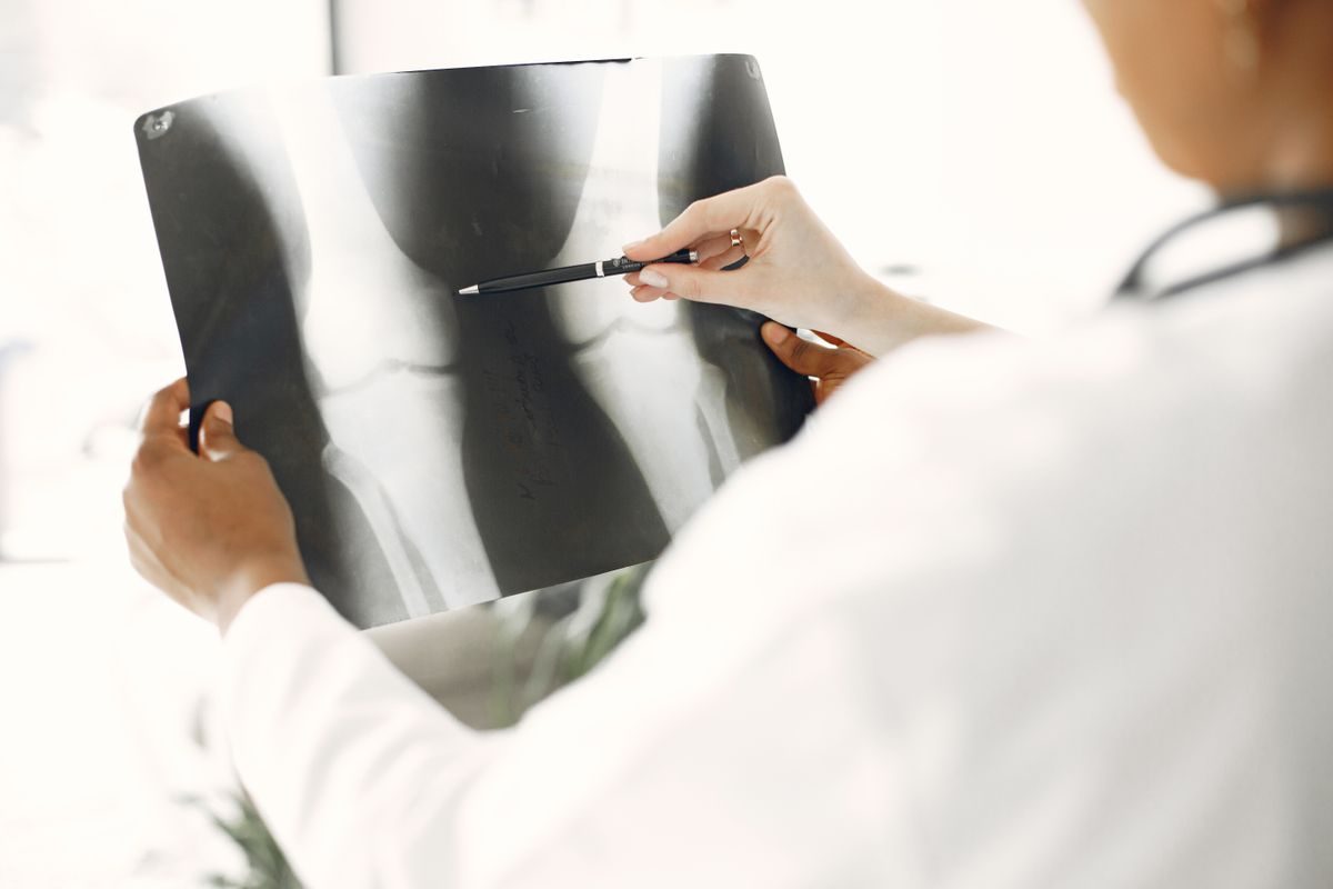 Doctor pointing to a knee X-ray while consulting with a patient